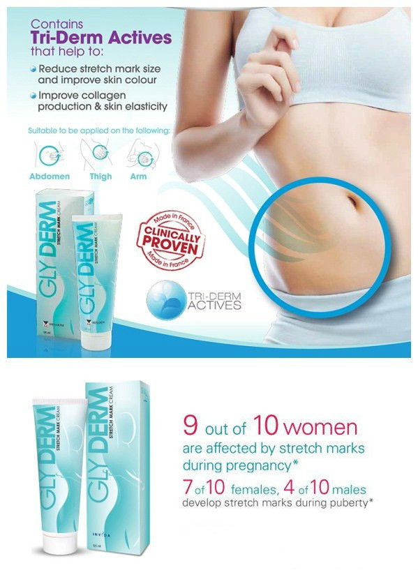 how to get rid of stretch marks