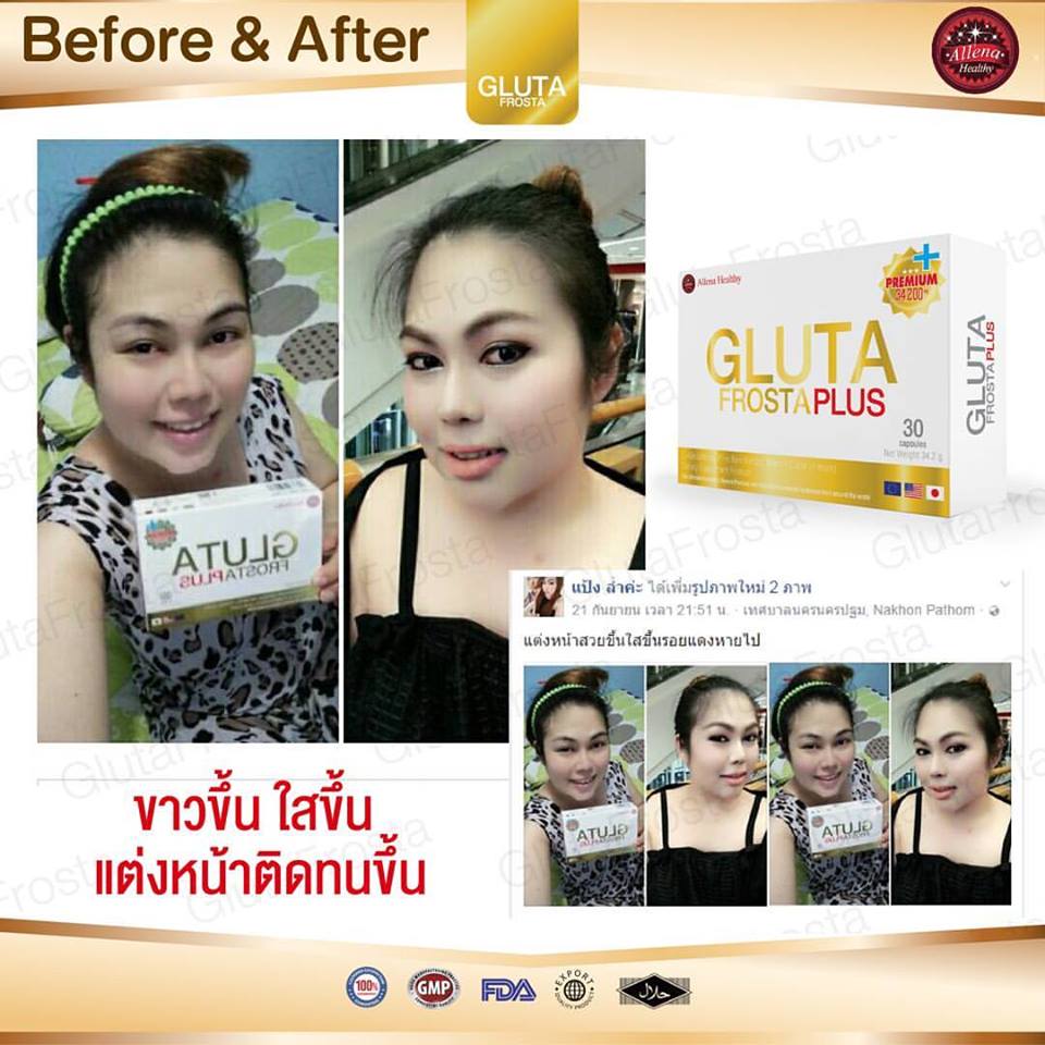 Gluta Frosta Plus