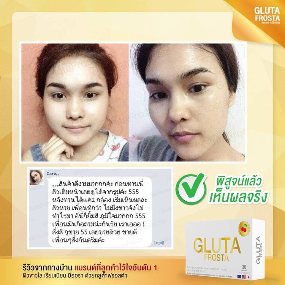 Gluta Frosta Plus