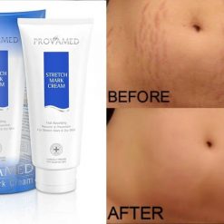 Provamed Stretch Mark Cream
