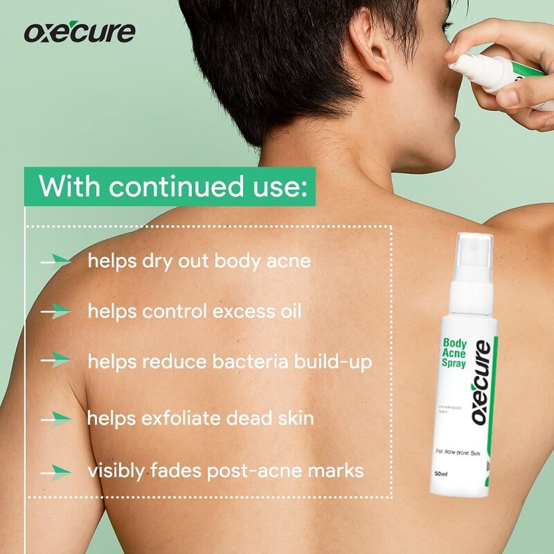 Oxe Cure Body Acne Spray