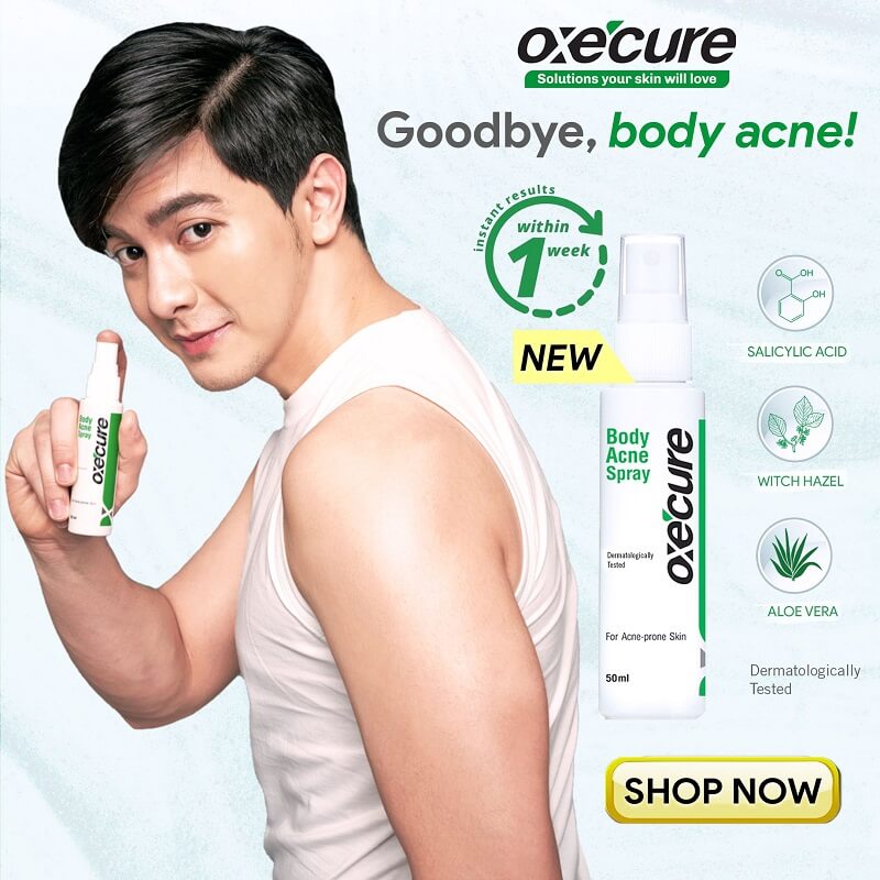 Oxe Cure Body Acne Spray