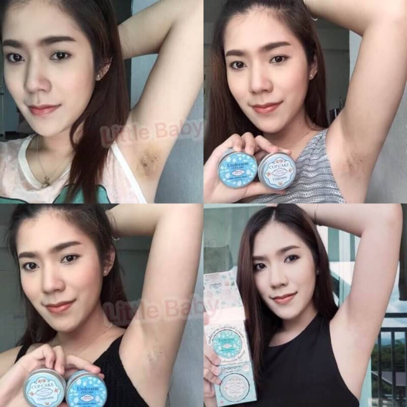 Set Underarm Cupcake Cream Day +Night