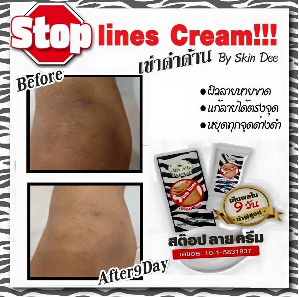 stop lines cream3