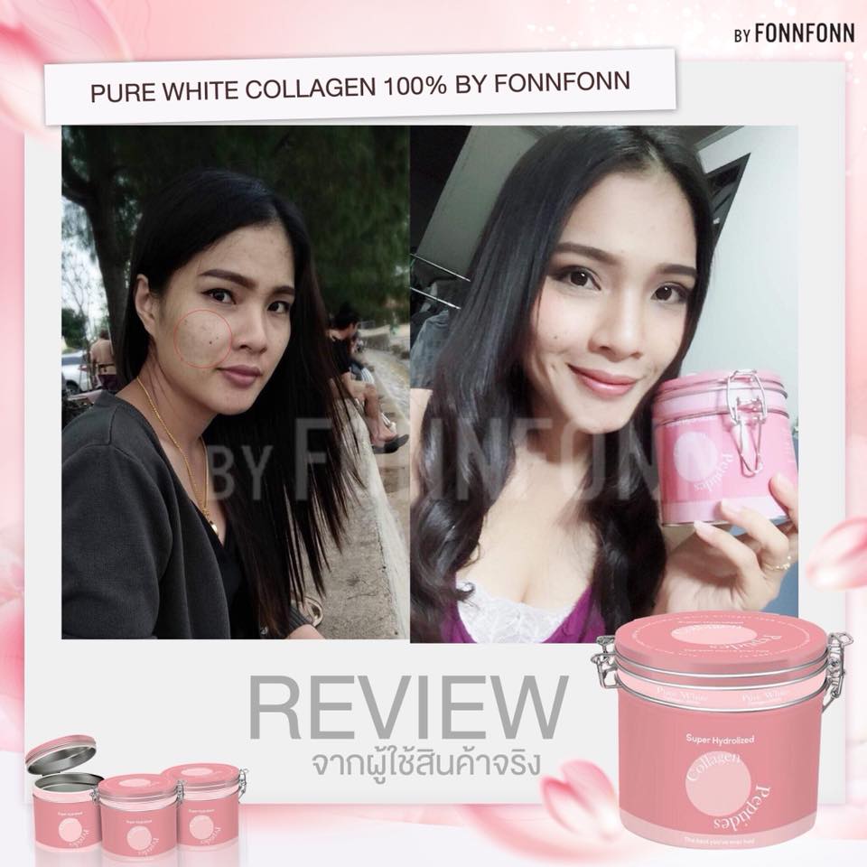 Pure white collagen by fonnfonn