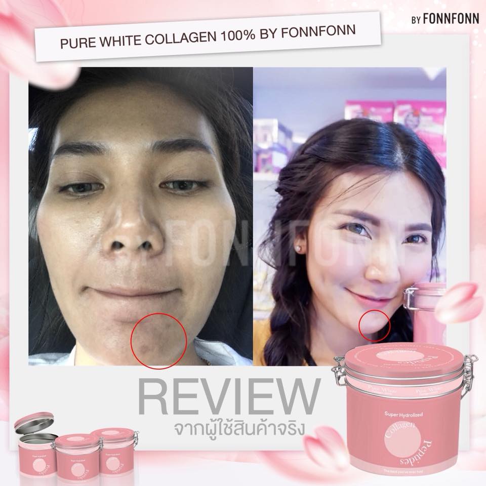 Pure white collagen by fonnfonn