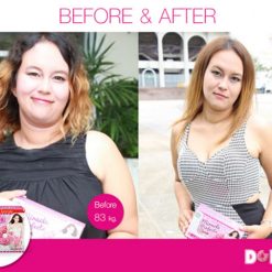 Donut Miracle Perfecta Srim
