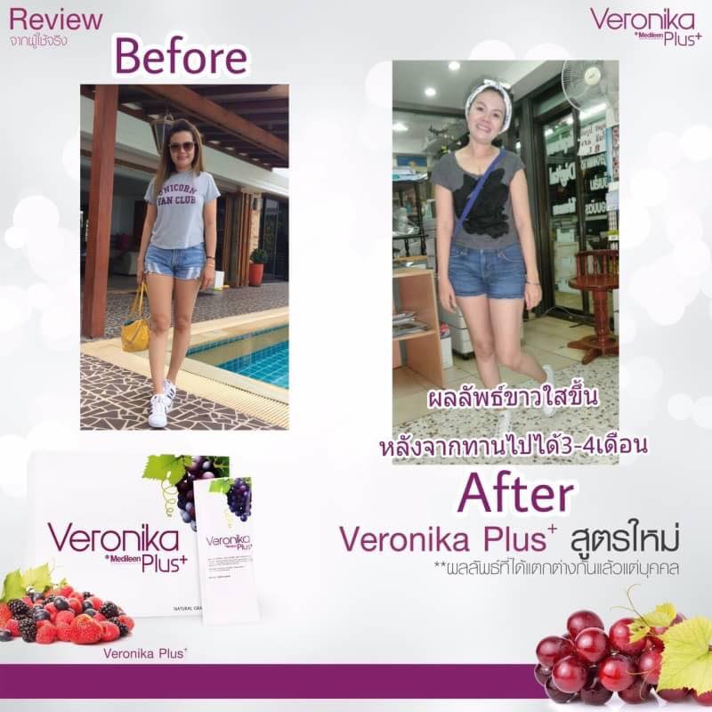 Veronika Plus by Medileen