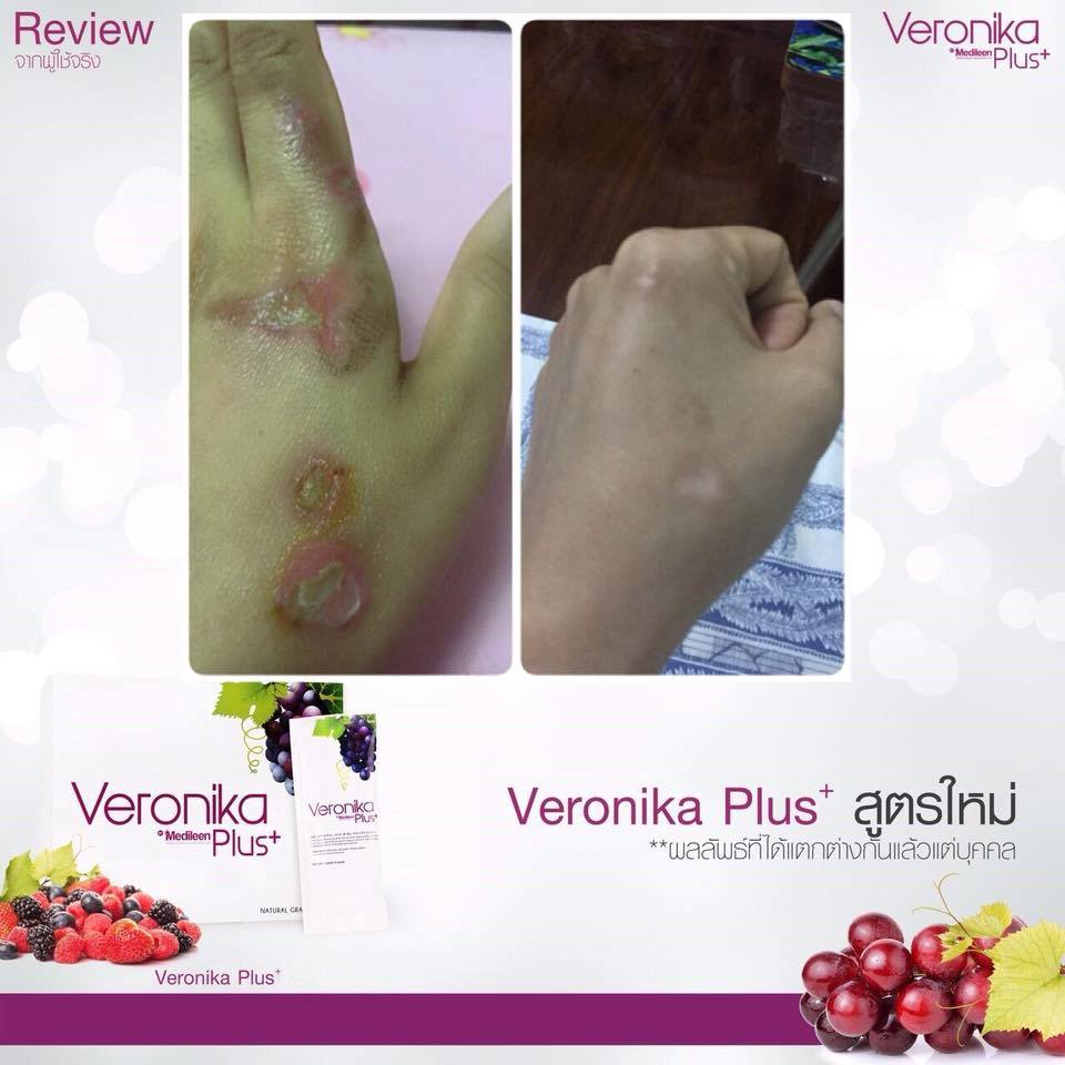 Veronika Plus by Medileen