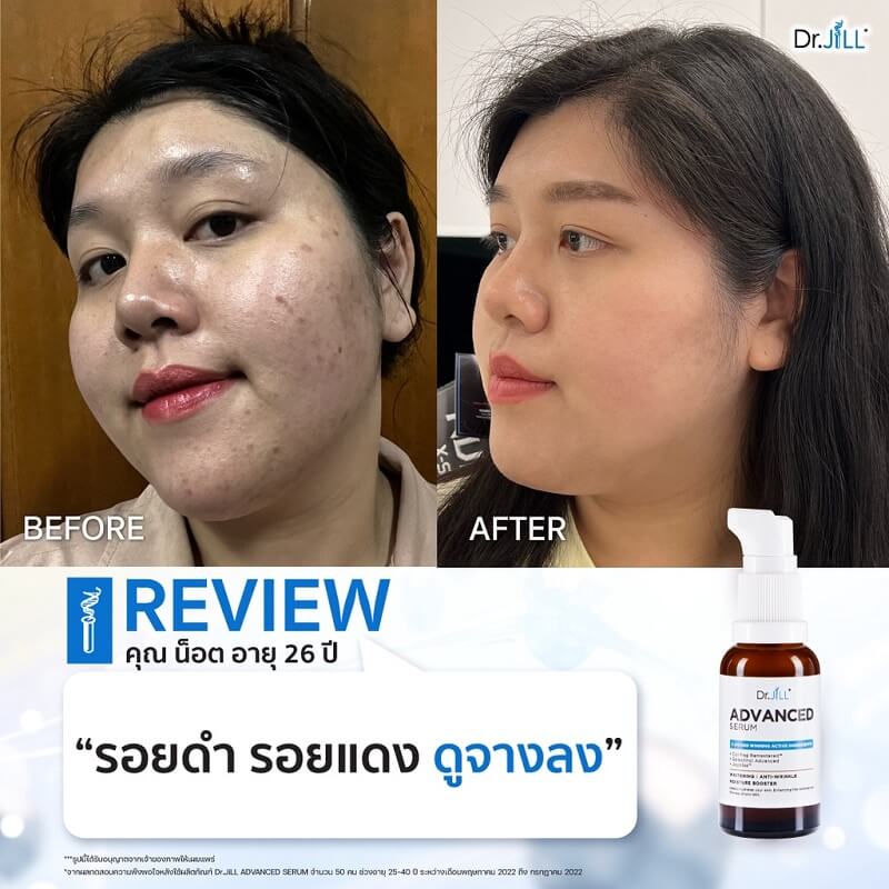 Dr.JiLL Advanced Serum Review