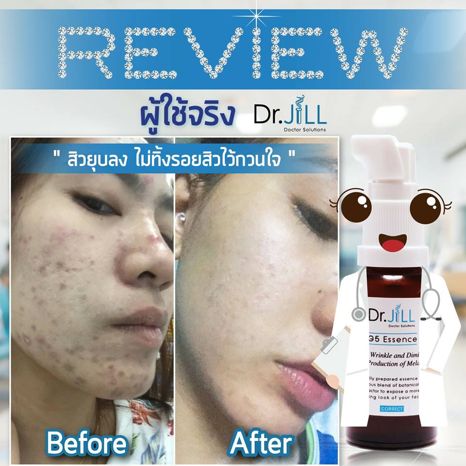 Dr.Jill G5 Essence