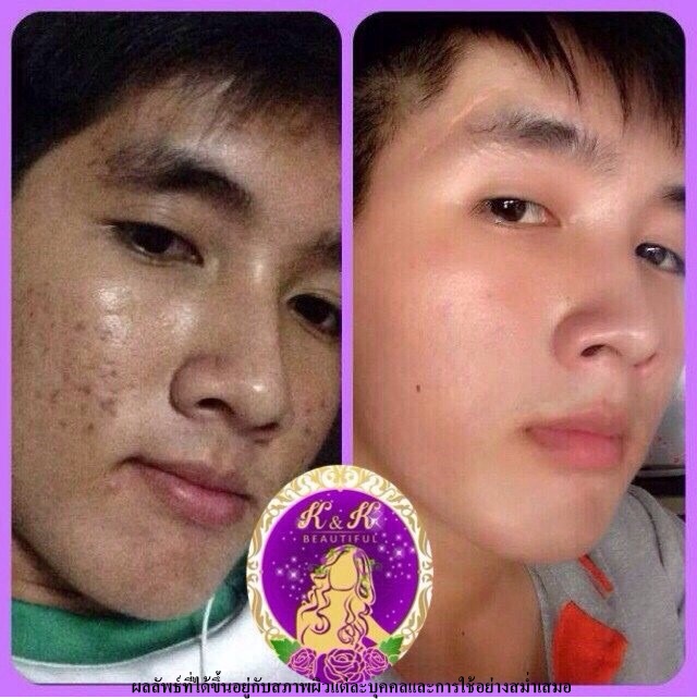 Grape skin cream K & K Beautiful5