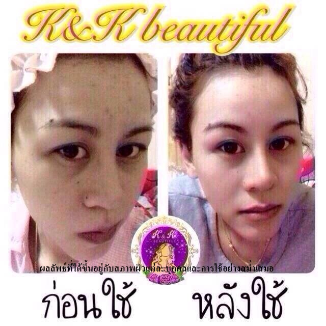 Grape skin cream K & K Beautiful7