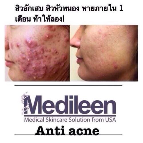 Medileen anti acne serum2