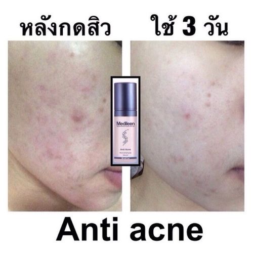 Medileen anti acne serum6