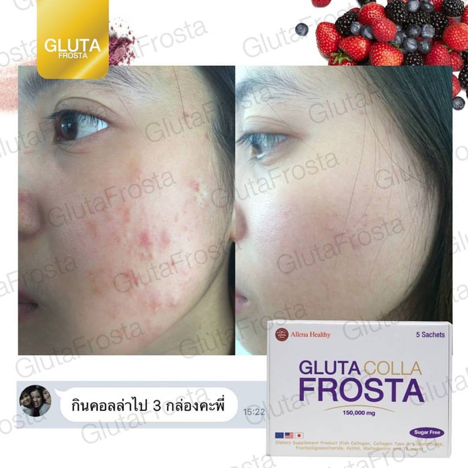 Gluta Colla Frosta