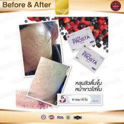 Gluta Colla Frosta