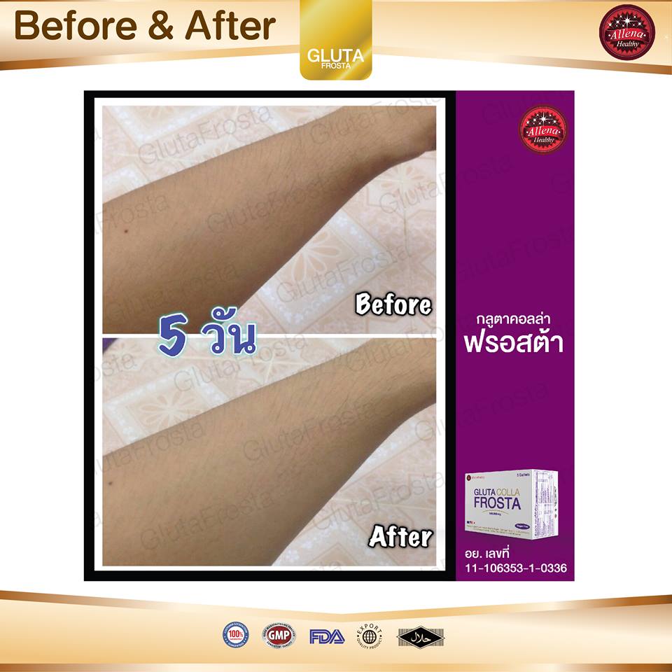 Gluta Colla Frosta