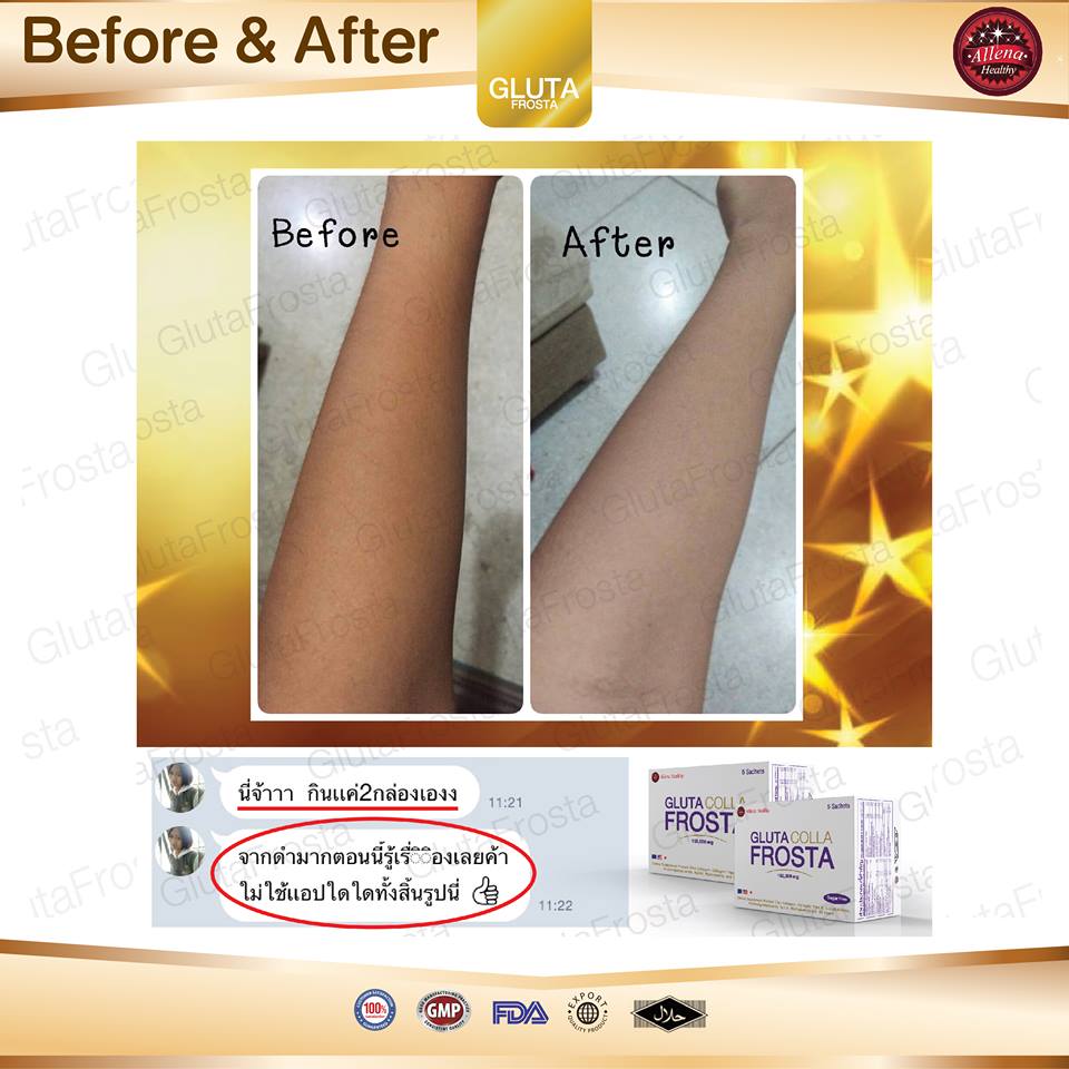 Gluta Colla Frosta