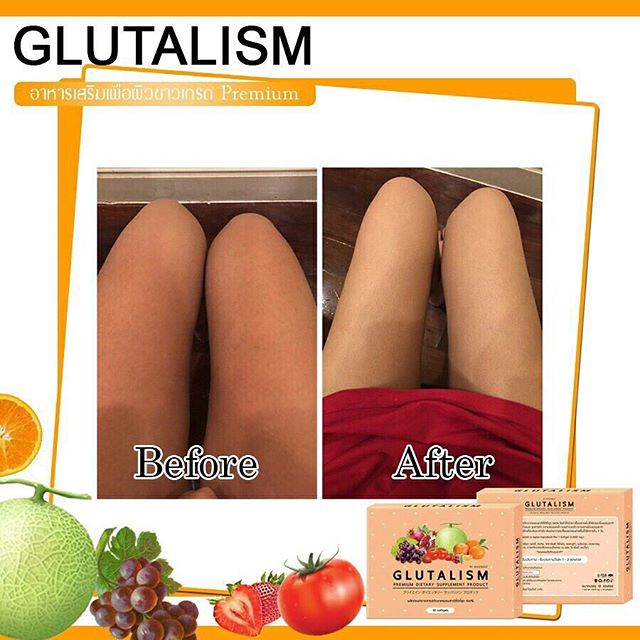 Glutalism4