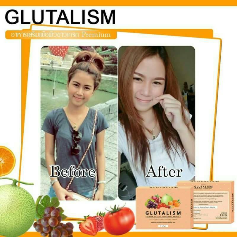 Glutalism6