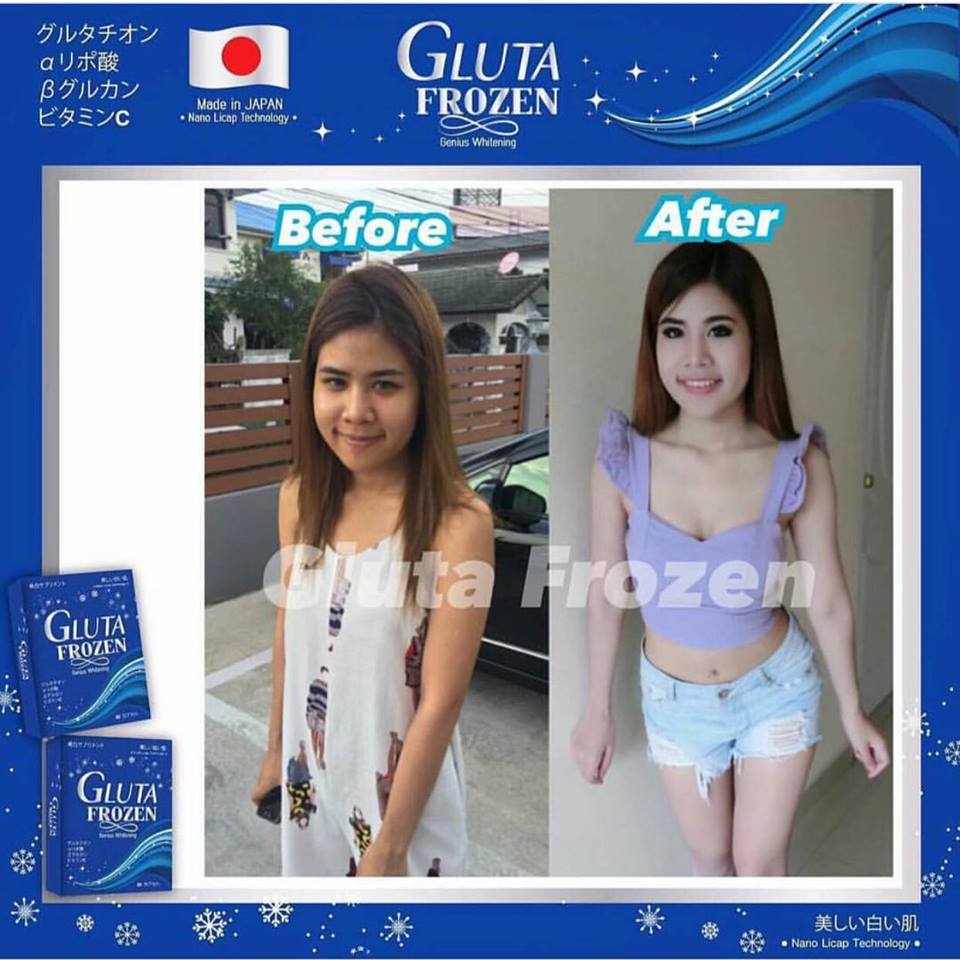 Gluta Frozen