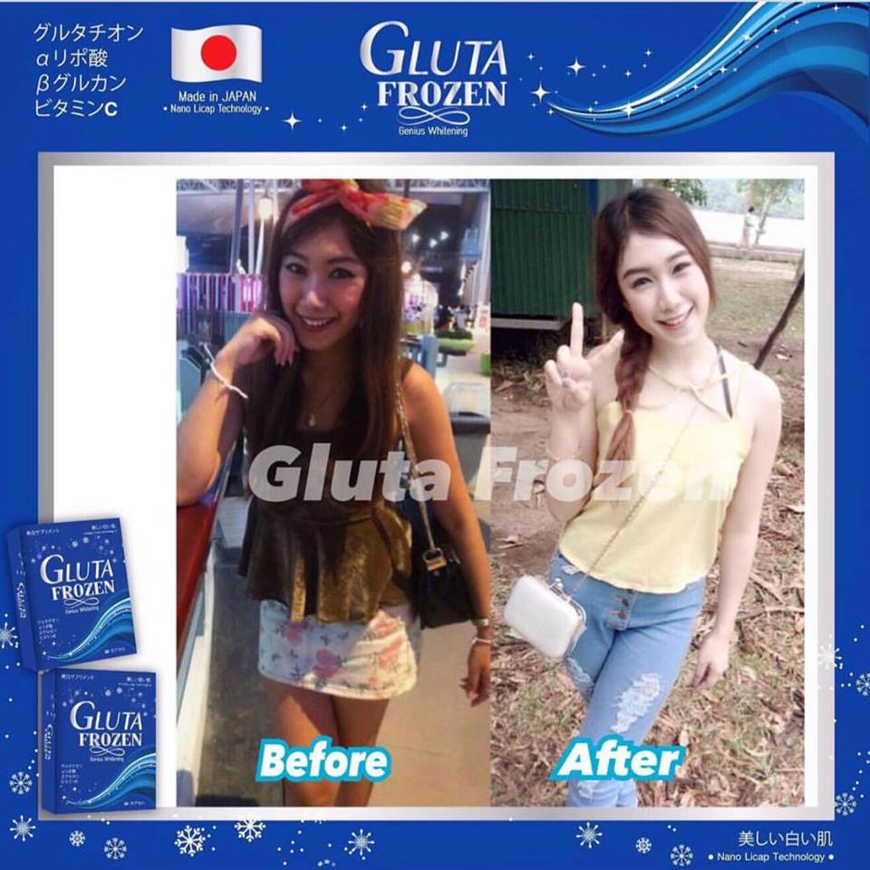 Gluta Frozen