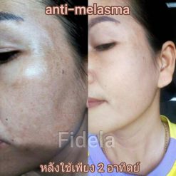 Fidela ANTI-MELASMA