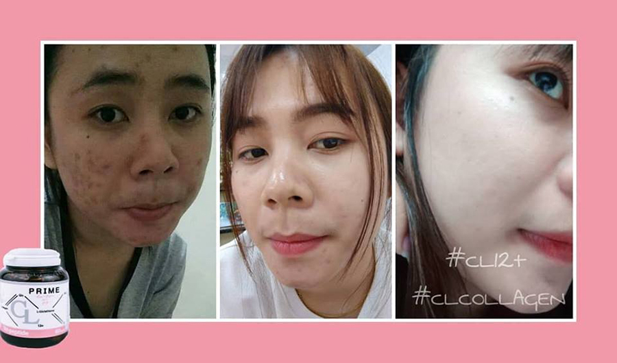 Prime CL Collagen12+