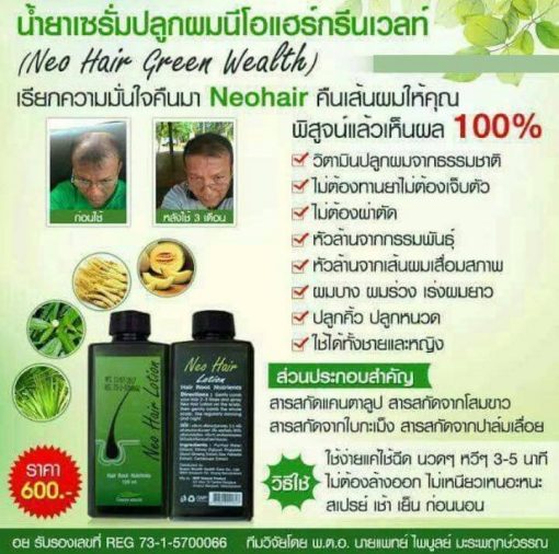 Neo Hair Lotion by Green Wealth Thailand Best Selling Products