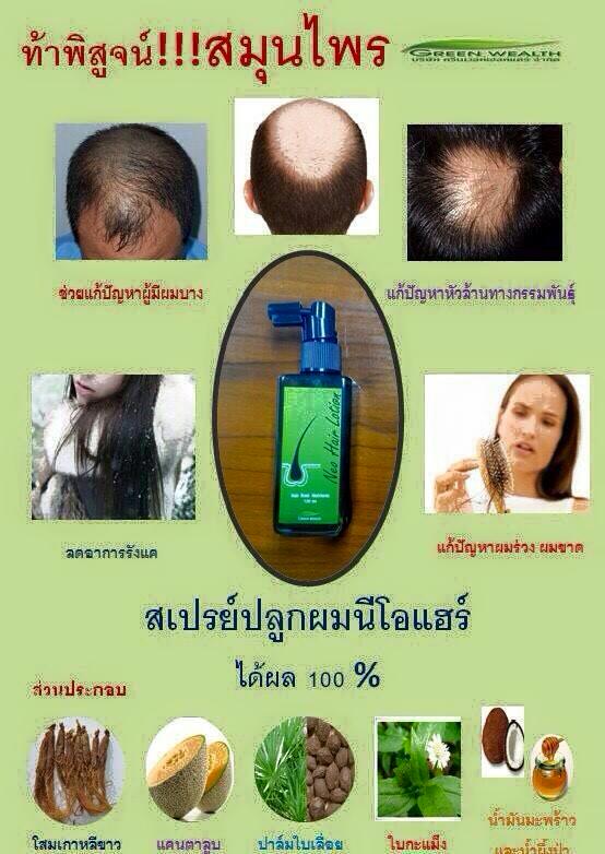 Neo Hair Lotion by Green Wealth - Thailand Best Selling Products - Online  shopping - Worldwide Shipping