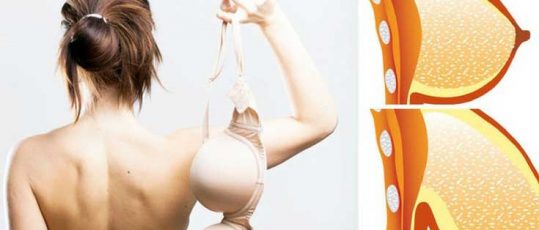 breast lift without surgery