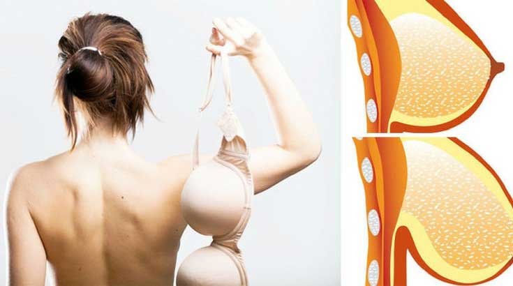 Non-Surgical Ways to Breast Lift - Thailand Best Selling Products