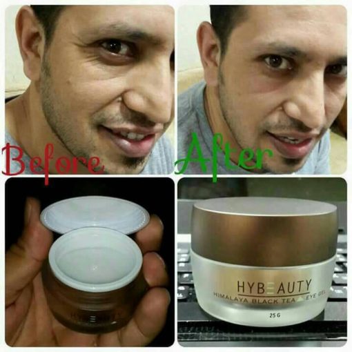 Hybeauty Himalaya Black Tea Eye Gel Thailand Best Selling Products