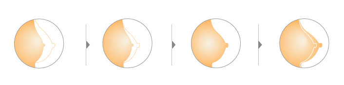 Pueraria Mirifica Breast Growth