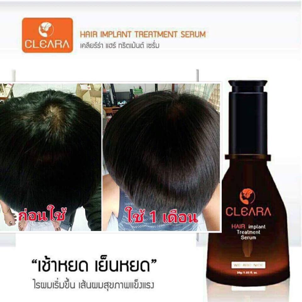 Cleara Hair Implant Treatment Serum