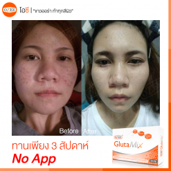 Ozee Gluta Mix L-Glutathion Collagène - Anti-âge, Contrôle Acné, 2 Unités