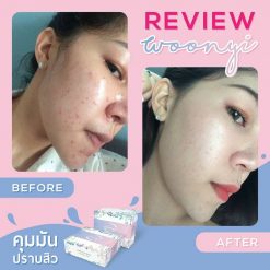 Woonyi Bubble de Mask Facial Soap