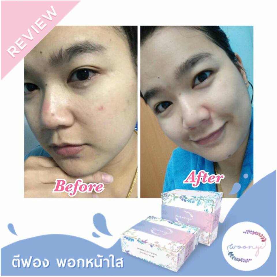 Woonyi Bubble de Mask Facial Soap