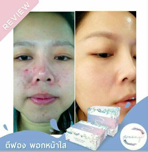 Woonyi Bubble de Mask Facial Soap