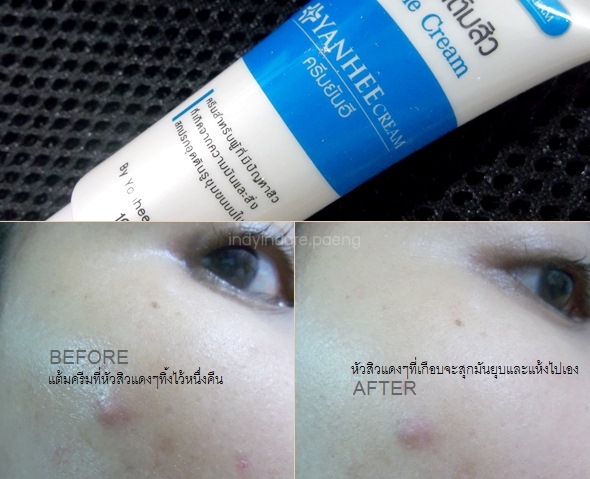 Yanhee Acne Cream