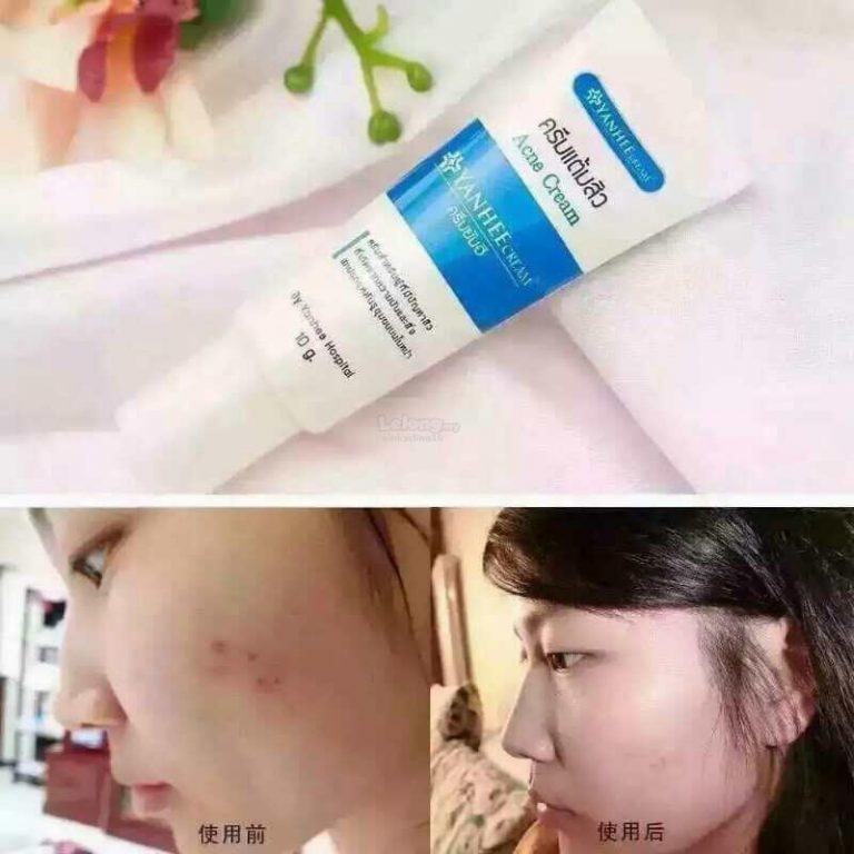 Yanhee Acne Cream Thailand Best Selling Products Yanhee Acne Cream Thailand Best Selling Products
