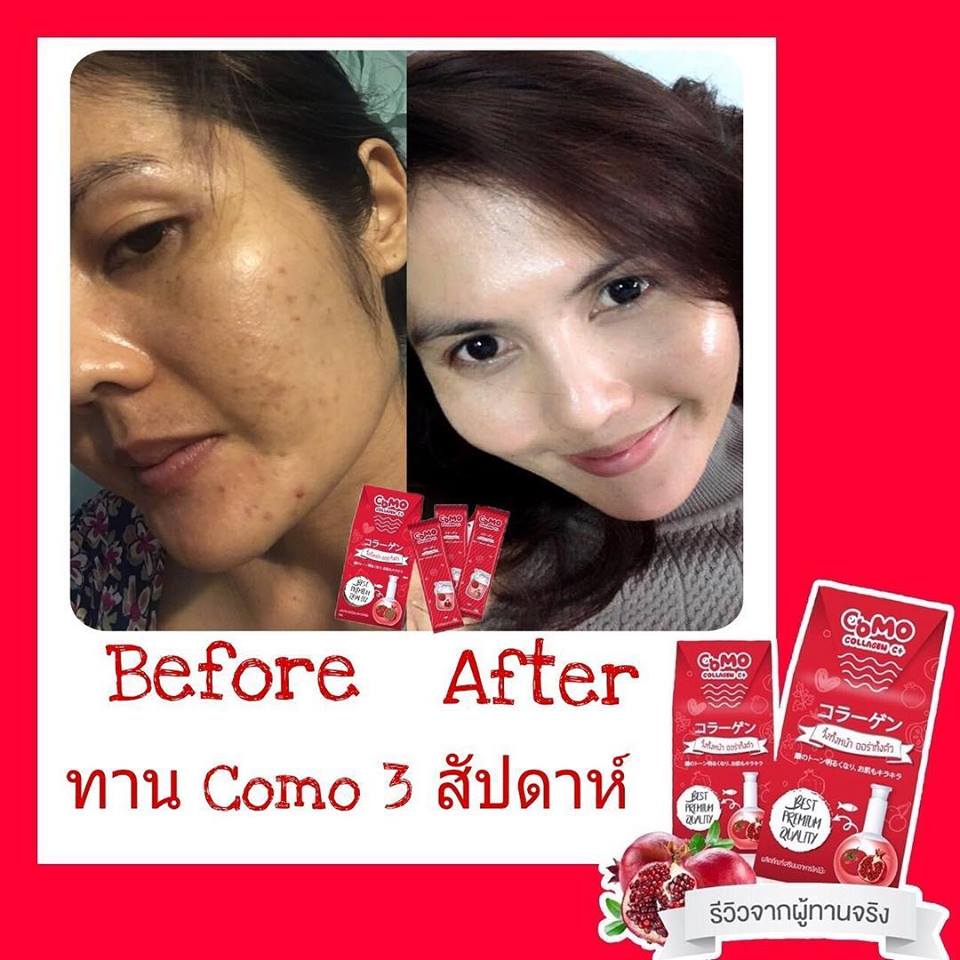 Como Collagen C+