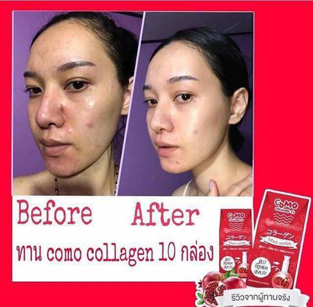 Como Collagen C+