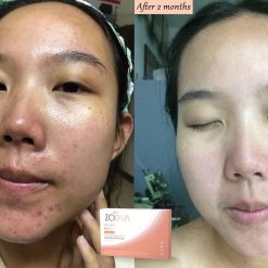 Zodiva Gluta