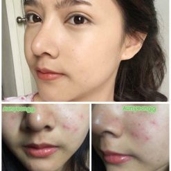 Aun-yeongg Collagen