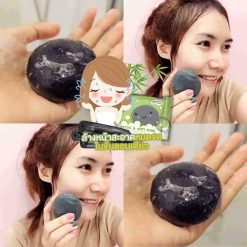 DETOX & ANTI ACNE by ami SKINCARE is the detox soap to treat all acne problems and the cause of acne. It helps absorb toxic substances and prevents skin from pollution in each day. It excellently cleanses the face thoroughly and detoxifies skin within one step.