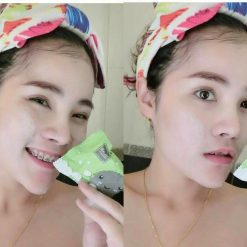 DETOX & ANTI ACNE by ami SKINCARE is the detox soap to treat all acne problems and the cause of acne. It helps absorb toxic substances and prevents skin from pollution in each day. It excellently cleanses the face thoroughly and detoxifies skin within one step.