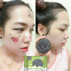 DETOX & ANTI ACNE by ami SKINCARE is the detox soap to treat all acne problems and the cause of acne. It helps absorb toxic substances and prevents skin from pollution in each day. It excellently cleanses the face thoroughly and detoxifies skin within one step.