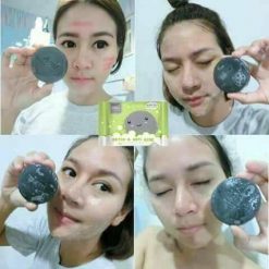 DETOX & ANTI ACNE by ami SKINCARE is the detox soap to treat all acne problems and the cause of acne. It helps absorb toxic substances and prevents skin from pollution in each day. It excellently cleanses the face thoroughly and detoxifies skin within one step.